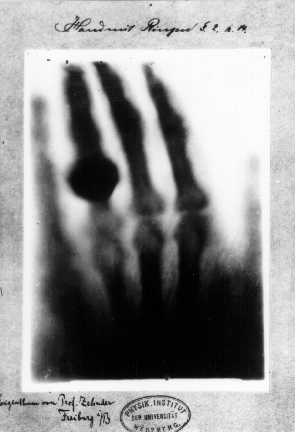 First X-Ray Image