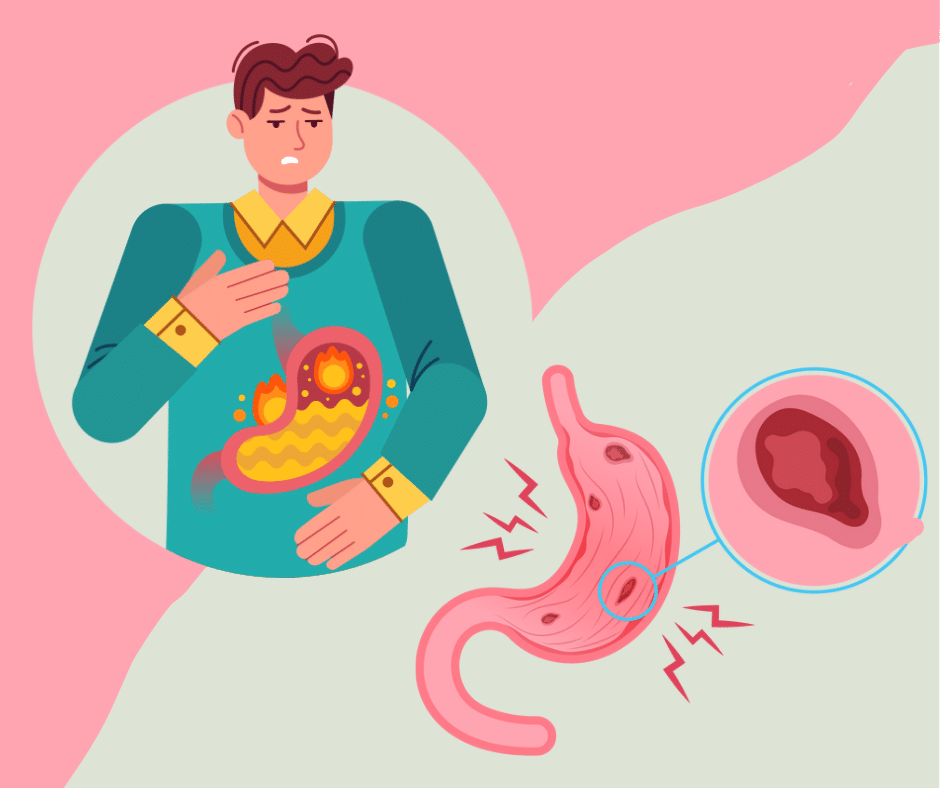 stomach bacteria